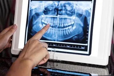 Dr. Thayer reviewing a patient's dental X-rays at Brite Dental Partners